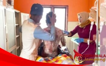 Remaja di Plampang Diduga Dibakar Ibu Kandung, Polisi Lakukan Penyelidikan