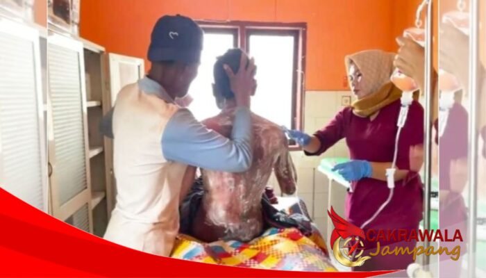 Remaja di Plampang Diduga Dibakar Ibu Kandung, Polisi Lakukan Penyelidikan